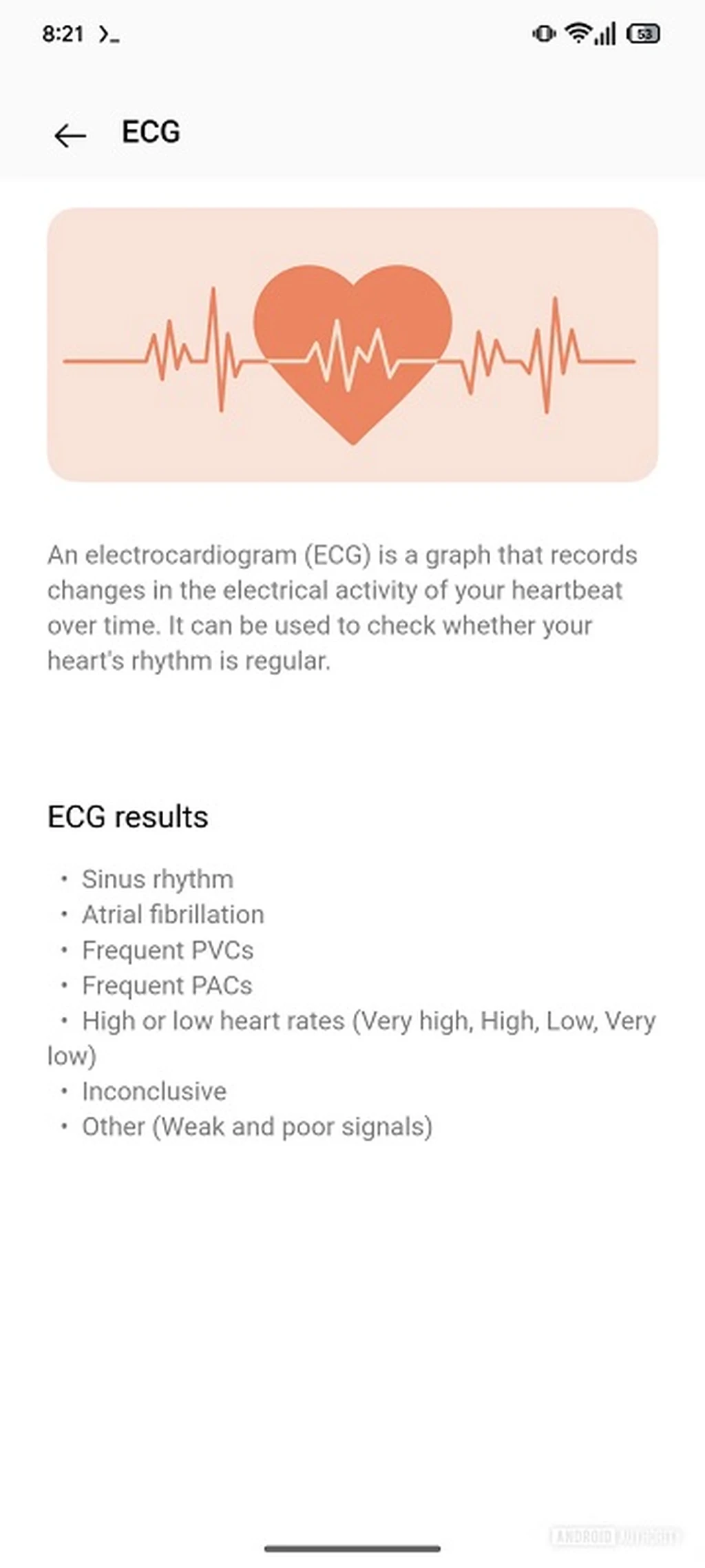 قابلیت ECG وان پلاس واچ ۳